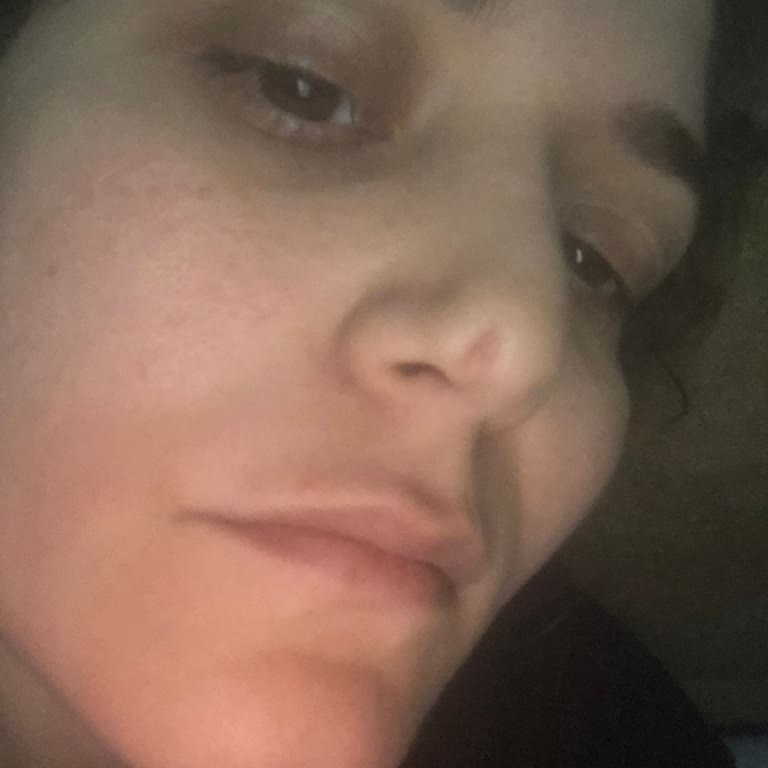 Burun Estetiği Operasyonundan Sonra Ciddi Sağlık Problemleri Ve Çözüm Eksikliği