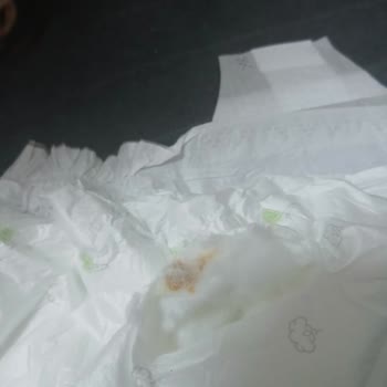 Bebek Bezinde Sert Yabancı Parça Bulundu, Güvenimiz Sarsıldı