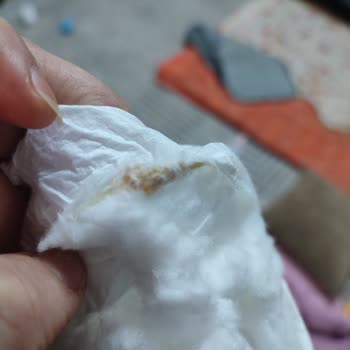 Bebek Bezinde Sert Yabancı Parça Bulundu, Güvenimiz Sarsıldı