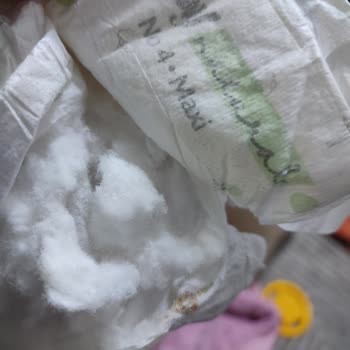 Bebek Bezinde Sert Yabancı Parça Bulundu, Güvenimiz Sarsıldı