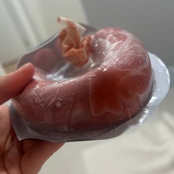 Fermente Sucukta Sıvılaşma Ve Macun Kıvamı Kalite Sorunu