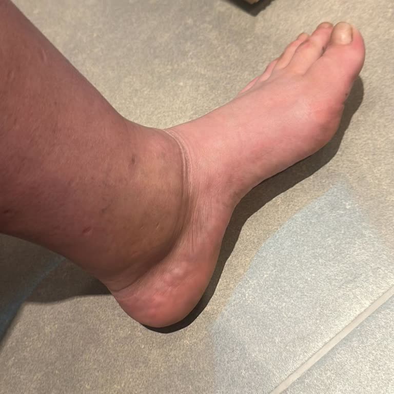 Acil Sağlık Durumu Gözardı Edilen Uçuş İptali Ve Uzun Bekleme