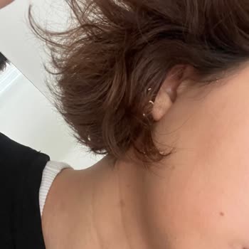 L’Oreal Revitalift Ürünlerinde Topaklanma Ve Cilde Emilmeme Sorunu