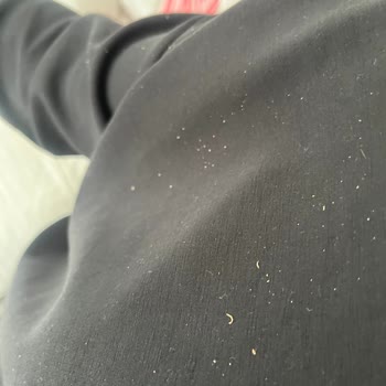 L’Oreal Revitalift Ürünlerinde Topaklanma Ve Cilde Emilmeme Sorunu