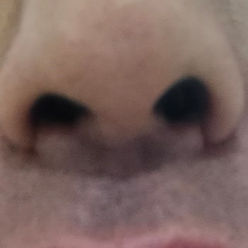 Op. Dr. Mehmet Taylan Güçlütürk Burun Estetiği Sonucu Memnuniyetsizliği Ve Ücret İadesi Talebi