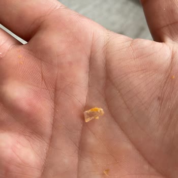 Cam Parçası Bulunan Kahvaltılık Üründe Güvenlik Krizi