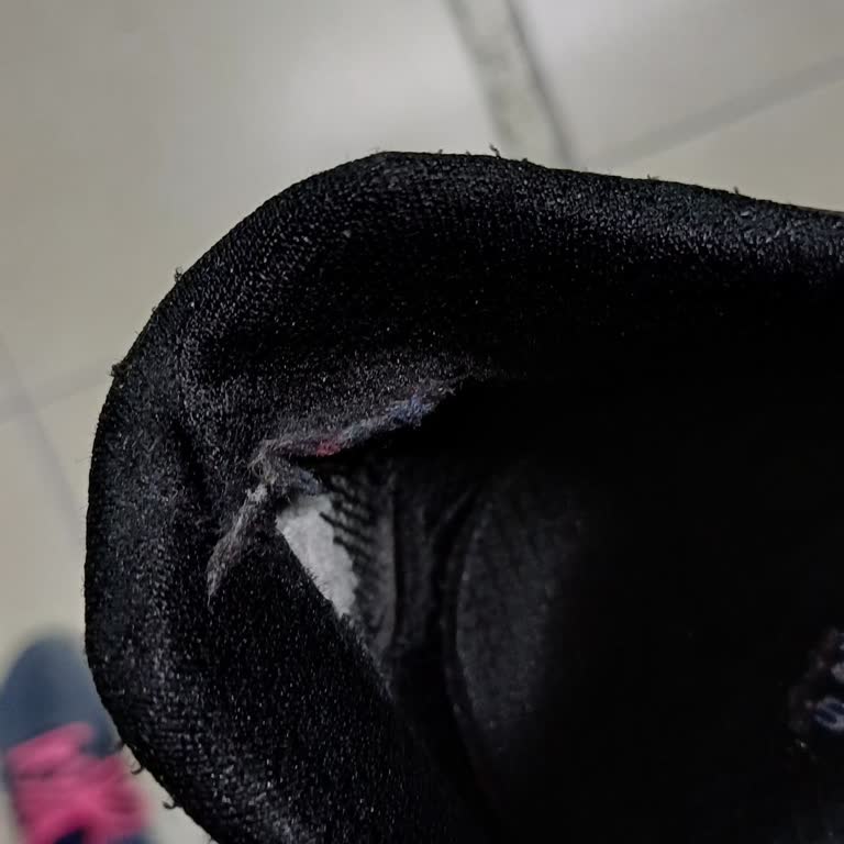 Skechers Ayakkabısının İç Topuğu Bir Ayda Açıldı, Mağaza Yardımcı Olmadı