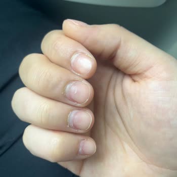 Hijyen Kurallarına Uymayan Manikür Ve 400 TL İade Talebi