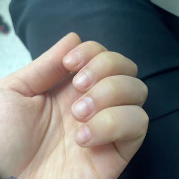 Hijyen Kurallarına Uymayan Manikür Ve 400 TL İade Talebi