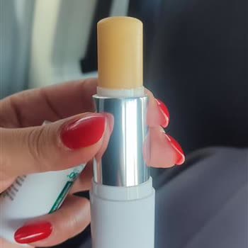 Ürün İncelemesi Reddedildi: Alerjik Reaksiyon Ve Çözüm Talebi