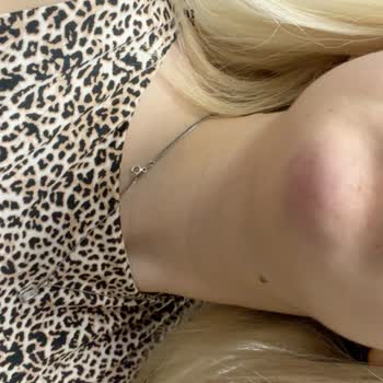 Dr. Alsuu Kızarıklık Ve İz Hâlâ Devam Ediyor Ve Çenem Üzerine Yatamıyorum