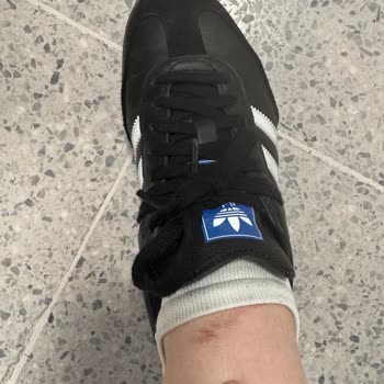 Adidas Samba Ayakkabısının Tasarım Hatası Yüzünden Ağrılı Kullanım Ve İade Talebi