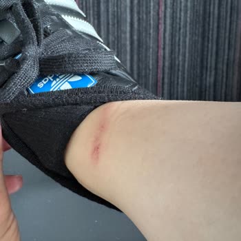 Adidas Samba Ayakkabısının Tasarım Hatası Yüzünden Ağrılı Kullanım Ve İade Talebi