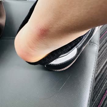 Adidas Samba Ayakkabısının Tasarım Hatası Yüzünden Ağrılı Kullanım Ve İade Talebi