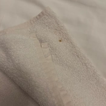Çankaya Otel’de Su Sızıntılı Kahvaltı Ve Kirli Oda Temizliği Nedeniyle İade Talebi