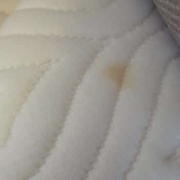 Biosalt Yatakta Lekeler Ve Eksik Servis