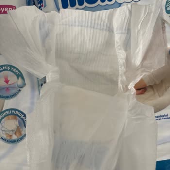 Molfix Bebek Bezinin Değişen Yapısı Ve Sızdırma Problemi, Ebebek İade Reddi