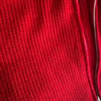 Hatalı Hırka, Görsel Uyuşmazlığı Ve Müşteri Hizmetleri Sorunu