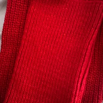 Hatalı Hırka, Görsel Uyuşmazlığı Ve Müşteri Hizmetleri Sorunu