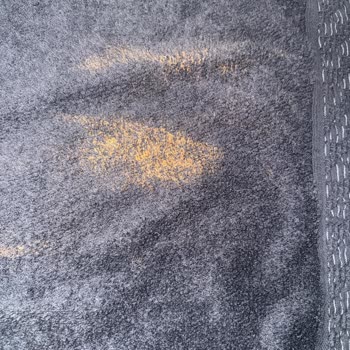 Aşırı Tüy Dökülmesi Ve Renk Değişimi Nedeniyle Özdilek Bornoz Takımında Ayıplı Ürün Şikayeti