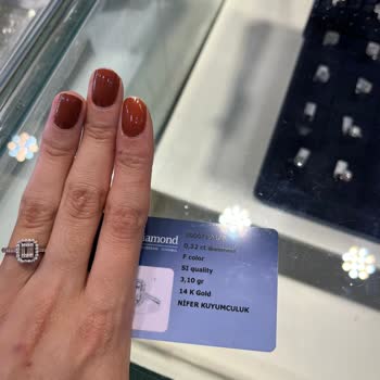 Tekrarlayan Kararma Ve Taş Düşmesi Sorunları İçin Ücretsiz Tamir Ve Masrafların İadesi Talebi