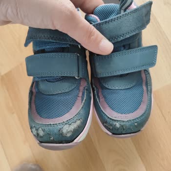 Bir Gün Kullanımda Açılan Ayakkabı: Kalite Sorunu Ve Ücret İadesi Talebi