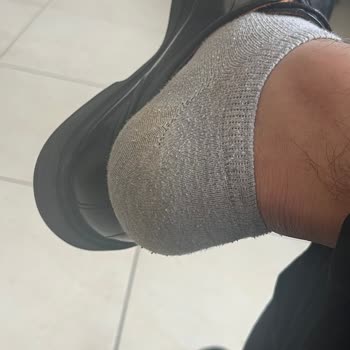 Greyder Ayakkabısında Çatlama Ve Boya Akması, İade Talebi Reddedildi