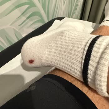 Skechers GO Walk Ayakkabısında Topuk Açılması Ve Garanti Reddi