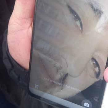 Kasa Eğilmesi Ve Çatlaklar Üretim Hatası Olarak Değerlendirilmedi