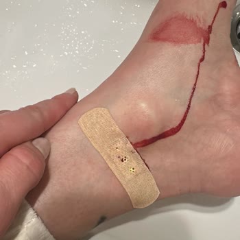 Vakıf Taşdelen Su Cam Damacana Güvenlik Kilidi Arızası Sonucu Ağır Yaralanma Ve Şirketin İlgisizliği