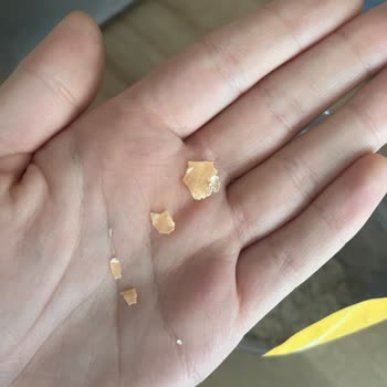 Eti Lifalif'te Yabancı Madde Bulunması Ve Cevapsız İletişim