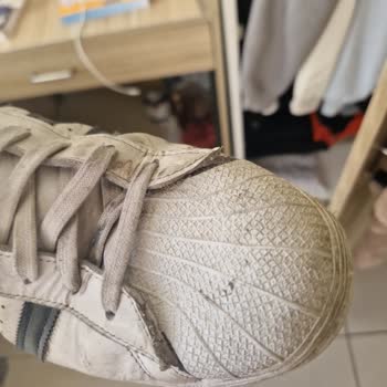 Adidas Superstar Ayakkabım Hızla Deforme Oldu, Garanti Reddiyle Mağdur Oldum