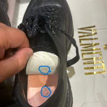 Üretim Hatası: Ayakkabının Gizli Çivi Parçaları Ayağımı Yaraladı, Mağaza Sorumluluğu Reddetti