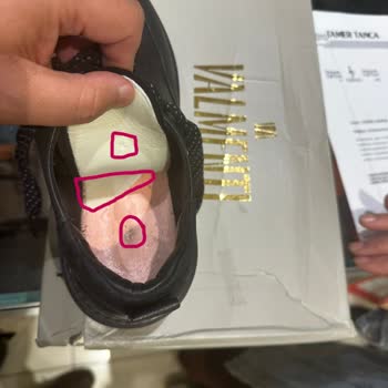 Üretim Hatası: Ayakkabının Gizli Çivi Parçaları Ayağımı Yaraladı, Mağaza Sorumluluğu Reddetti