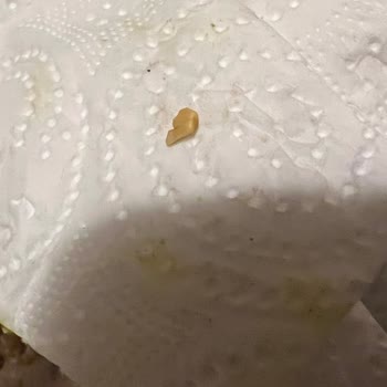 Yanlış Tatlı Gönderimi Ve Fıstık Kabuğu Diş Hasarına Sebep Oldu