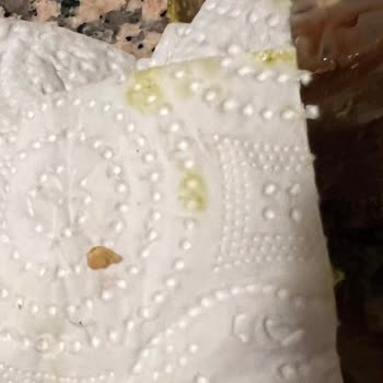 Yanlış Sipariş Ve Fıstık Kabuğu Diş Hasarı