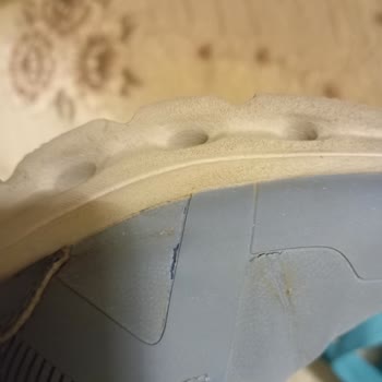 Kısa Sürede Yırtılan Çocuk Ayakkabısına Kullanıcı Hatası Denilmesi