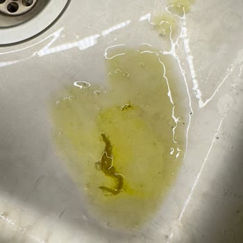 Kukuli Multivitamin Sıvısında Uzun Yabancı Madde Çıktı: Güvenlik Ve Hijyen Endişesi