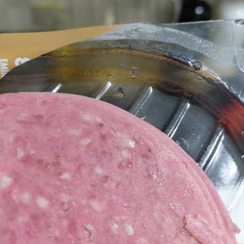 Emin Salamda Saç Tespiti Ve Hijyen Sorunu