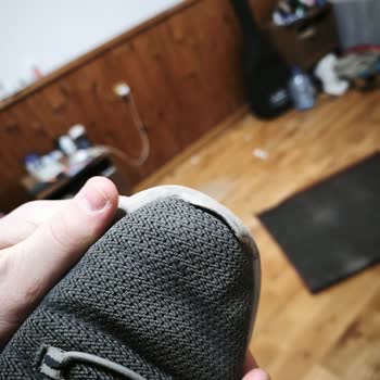 Skechers Ayakkabısının Yan Açılması Garanti Kapsamına Alınmadı