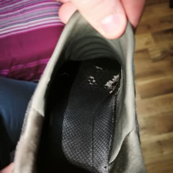 Skechers Ayakkabısının Yan Açılması Garanti Kapsamına Alınmadı