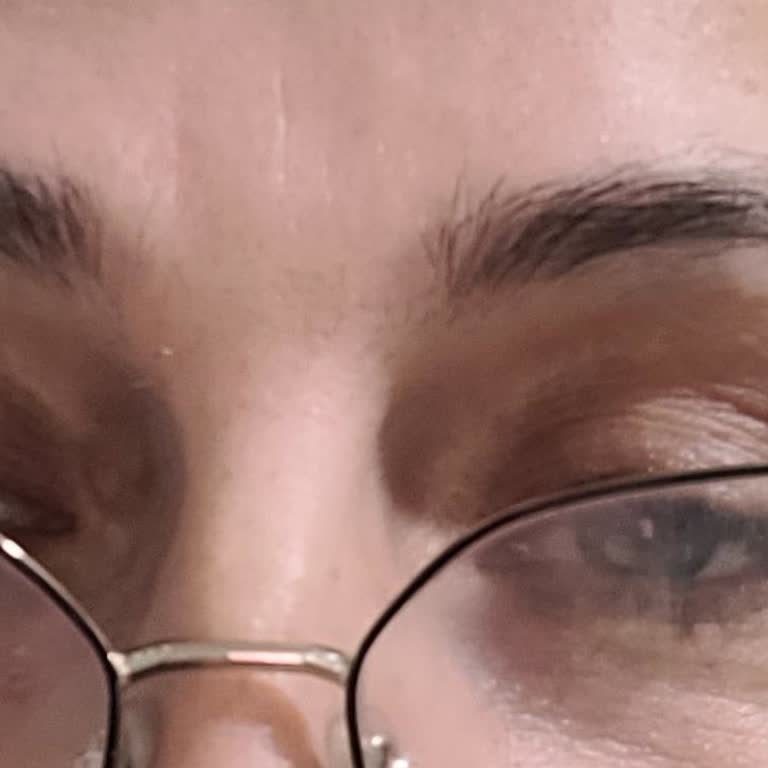 Kalıcı İzler Ve Sağlık Sıkıntısı Nedeniyle Geri Ödeme İsteği