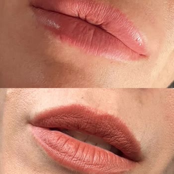 Dolgu İşlemi İki Kez Bozuldu Ve Yetkisiz Bıyık Doldurmasıyla Psikolojik Ve Maddi Mağduriyet