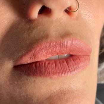 Dolgu İşlemi İki Kez Bozuldu Ve Yetkisiz Bıyık Doldurmasıyla Psikolojik Ve Maddi Mağduriyet