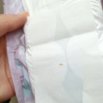 Molped Gece Pedi İçinde Yabancı Madde Görüldü