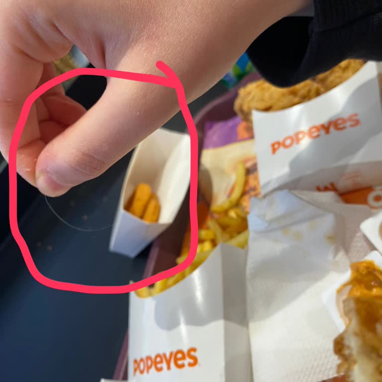 Popeyes Muğla Şubesinde Beyaz Kıl Ve Hijyen Sorunu