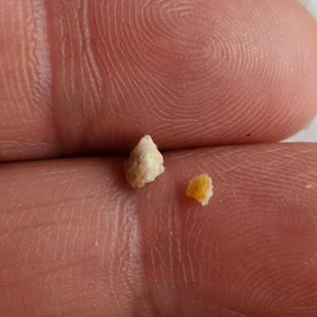 Migros Binevler Uzman Kasap’ta Kemikli Köfte Şikayetim Ve Telafi Talebi