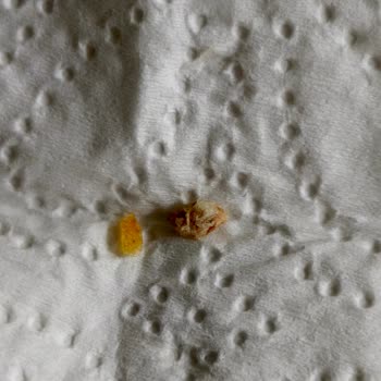 Migros Binevler Uzman Kasap’ta Kemikli Köfte Şikayetim Ve Telafi Talebi