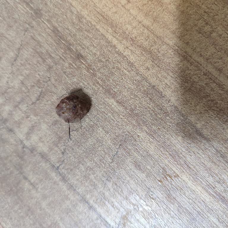 Coco Pops’ta Bulunan İp Parçası Hijyen Ve Güvenlik Sorunu