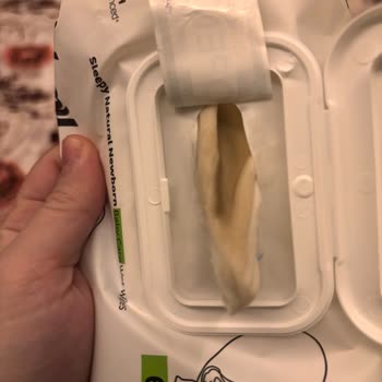 İçinde Küf Olan Yenidoğan Mendili Güvenimizi Sarsıyor